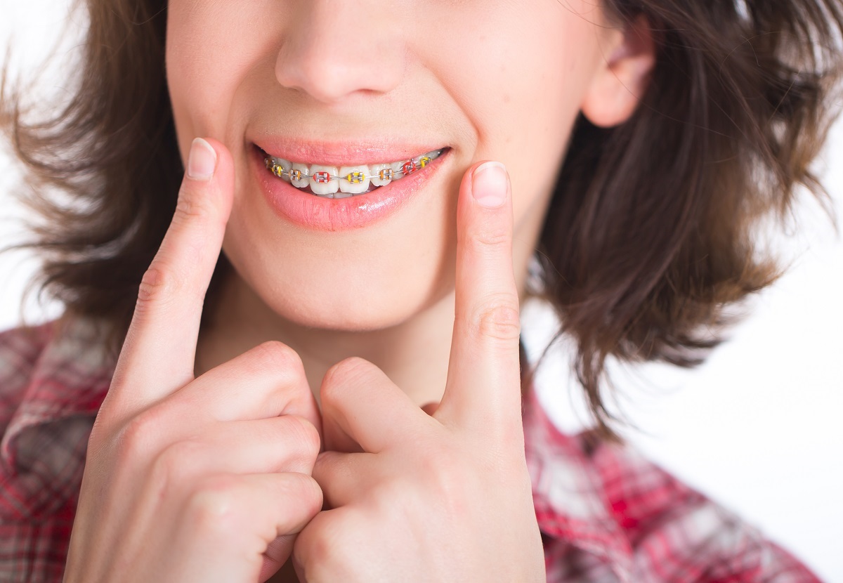Cost of Braces Kerr Orthodontics